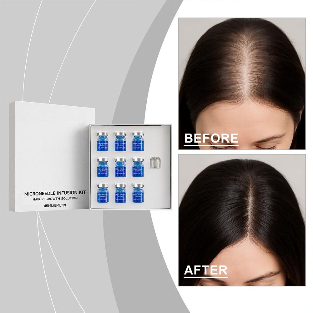 Hair Care Hair Serum - 0.25mm Hair Essential Serum Micro-needle Roller