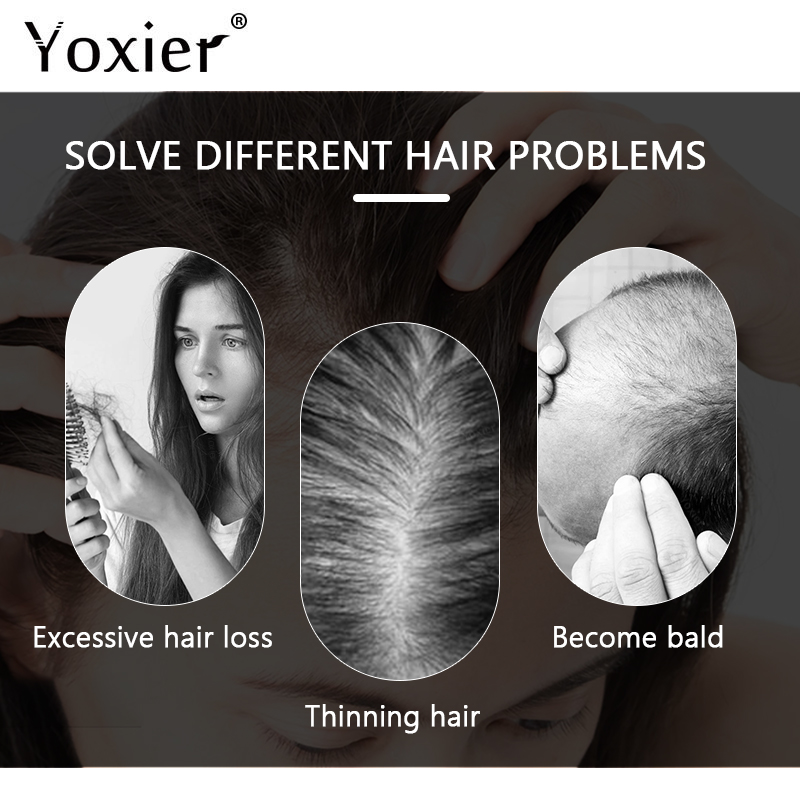 Intensive Growth Serum Prevent - Hair Care Hair Serum ulasan dan harga