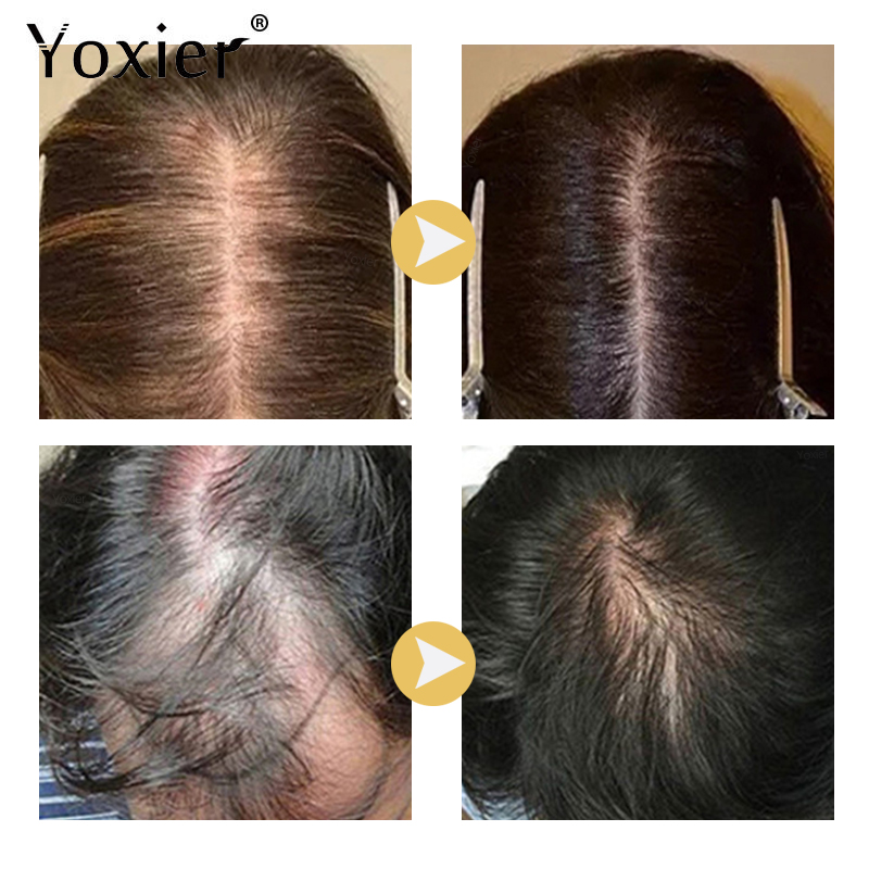 Intensive Growth Serum Prevent - Hair Care Hair Serum ulasan dan harga