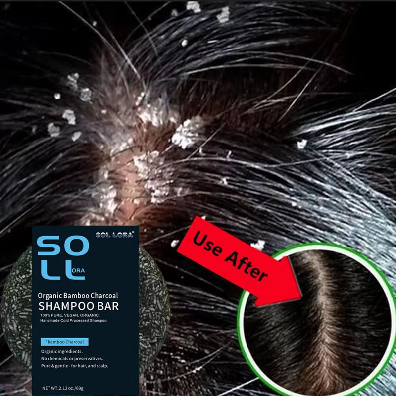 Fast Anti Dandruff Hair Treatm - Hair Care Dandruff ulasan dan harga