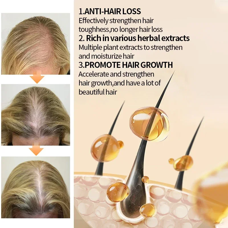Ginger Fast Hair Growth Spray  - Hair Care Hair Serum ulasan dan harga